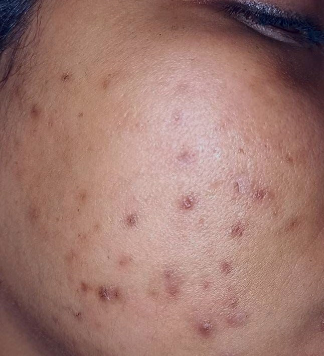 Cuidado facial
