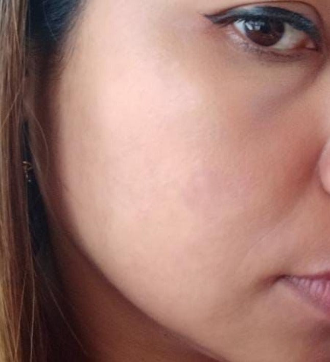 Cuidado facial
